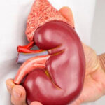 Kidney / Renal Transplant in India