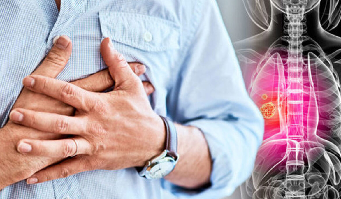 lung-cancer-banner