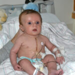Pediatric Cardiac Surgery in India