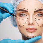 Plastic Surgery in India