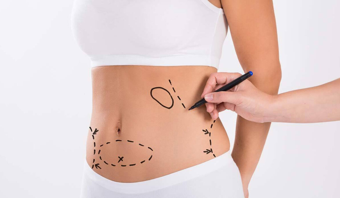 tummy-surgery-banner