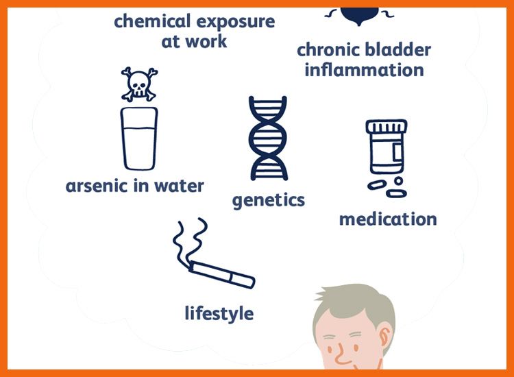 Causes-of-Bladder-Cancer